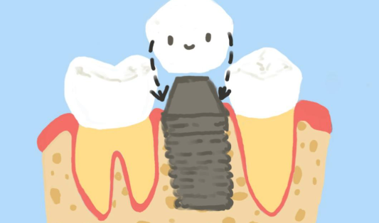 赵春平医生种牙口碑评价