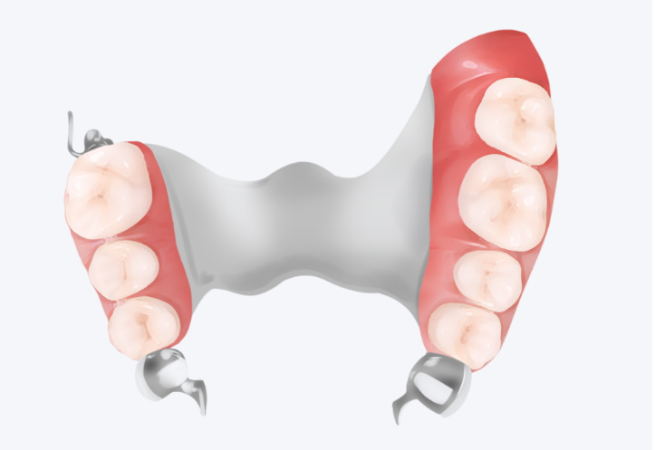 自貢牙科鑲牙價(jià)格一覽：烤瓷牙600起/全瓷牙2500起/種植牙7200起