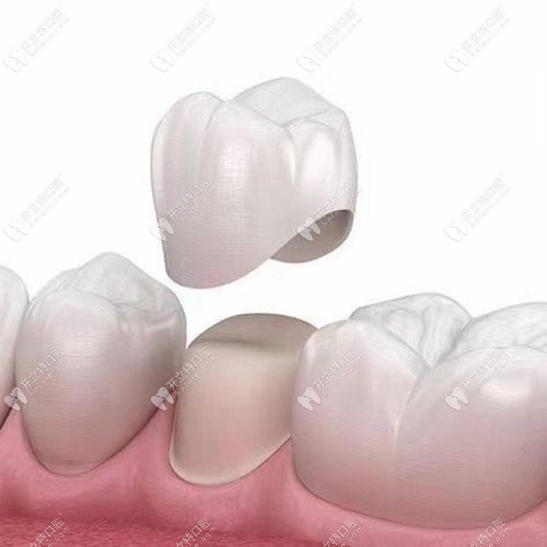 張鵬飛醫(yī)生擅長(zhǎng)項(xiàng)目 & 技術(shù)特色