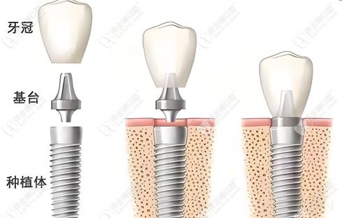 任曉峰醫(yī)生擅長項目 & 技術(shù)特色