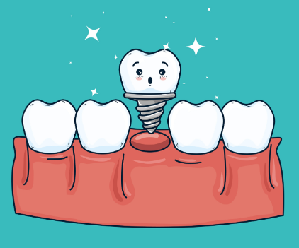 成都安玉牙种植医院价格合理吗