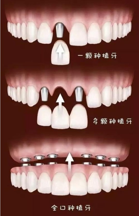 黄江街坊必存！康达口腔2025价目表来了，种植牙/矫正/补牙价格“接地气”，看完心里不慌