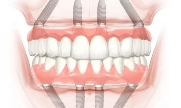 黄江康达口腔凭什么敢公开价目表？本地老牙科的“实在”优势