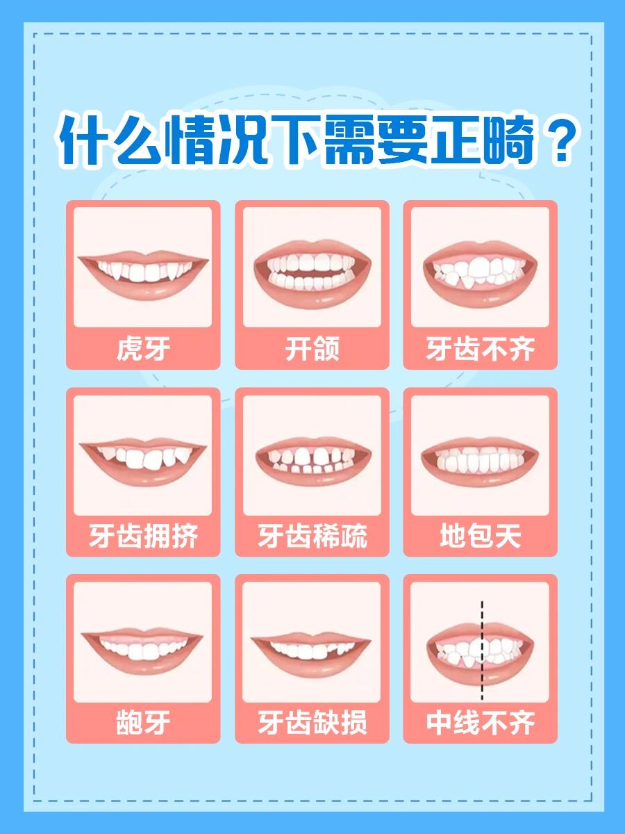 江安佳利口腔：正畸性价比高，学生党整牙不用吃土