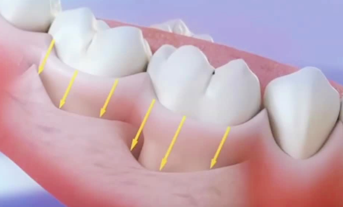郑州唯美口腔大学路店坐地铁1号线能到吗?1号线绿城广场站下车步行5分钟即到
