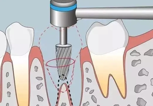 2026年在瓮安看牙，这3个避坑技巧一定要知道！