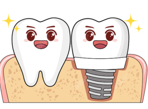 維密歐貝麗口腔種牙價格透明