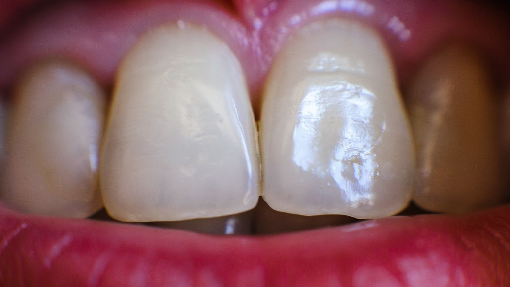 普寧牙科醫(yī)院綜合對比及選擇建議