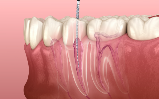 普寧牙科醫(yī)院項目/材料相關(guān)信息