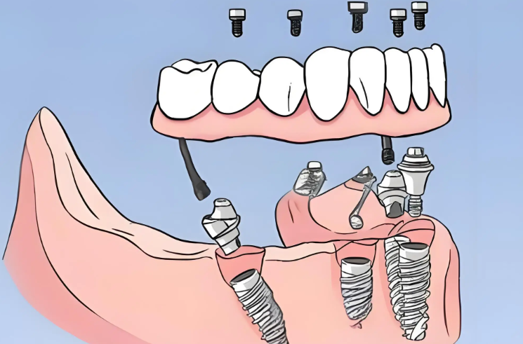 深圳希奧口腔有幾家分店