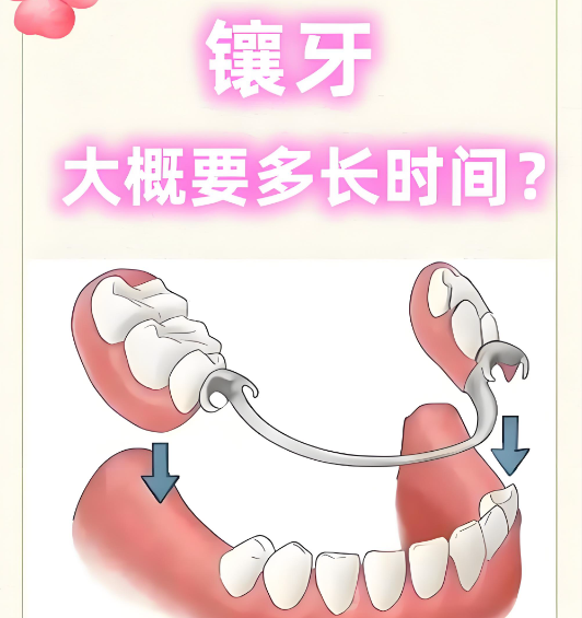深圳希奧口腔有幾家分店？新版揭秘：大芬總院+龍崗店共2家，活動義齒3000元起！