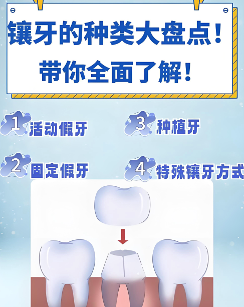 深圳希奧口腔特色技術(shù)與價(jià)格體系