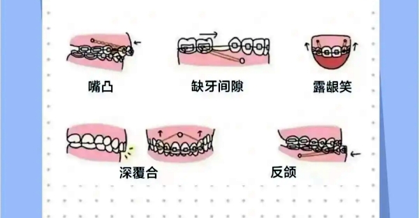 選擇陳啟鋒醫(yī)生團(tuán)隊(duì)的理由