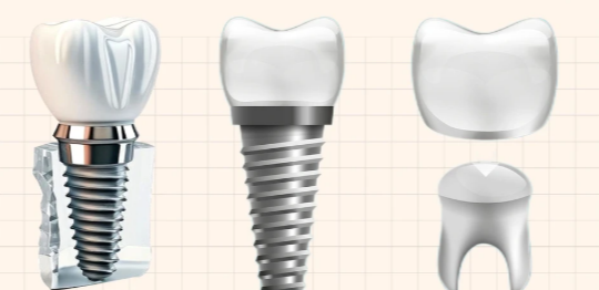 北京廷杰口腔種牙價(jià)目表來了！從2800到7899元起，不同預(yù)算都能選