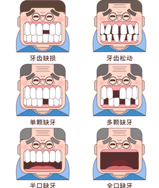 北京廷杰口腔種牙