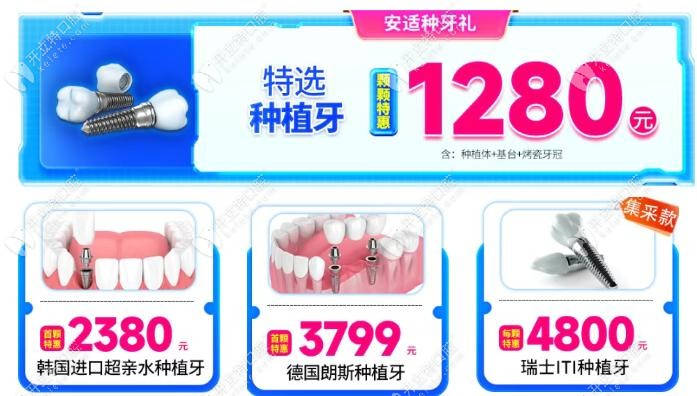 廣州廣大口腔種植牙1680?現(xiàn)僅需1280元起含種植體+基臺+烤瓷牙