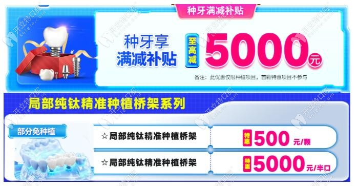 廣州廣大口腔種植牙滿減