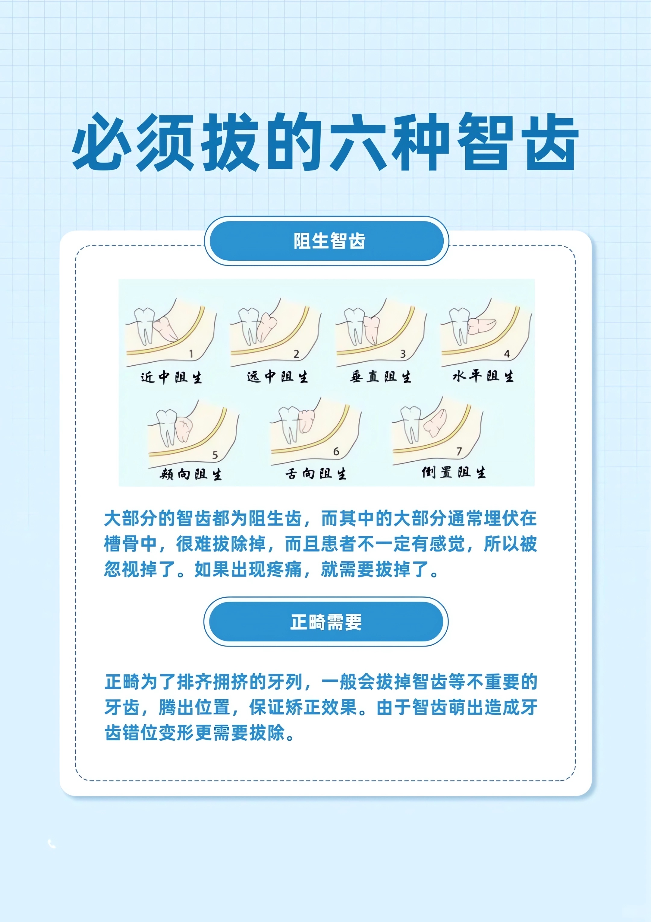 拔智齒前必看：這些情況可能讓價格“翻倍”，你中了幾個？