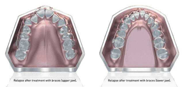 對比3家辛莊正規(guī)牙科醫(yī)院，做牙齒矯正收費比想象中便宜太多了