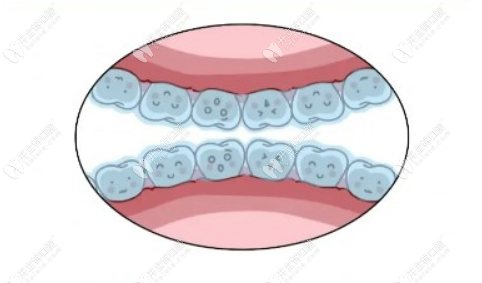 濰坊整牙做隱形牙套去哪個醫(yī)院好？面診后整理出有3家靠譜