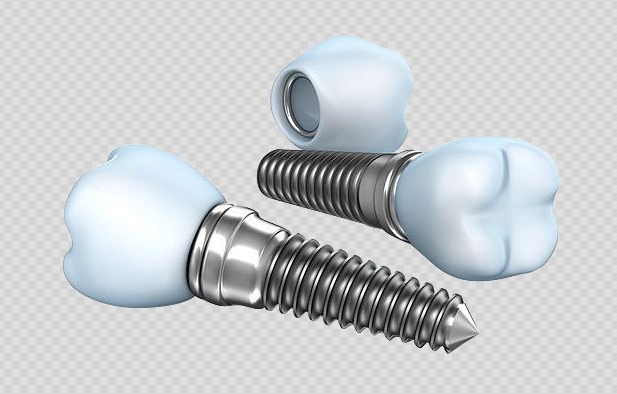 鹽城大為口腔牙齒矯正價格一覽gh0097.com
