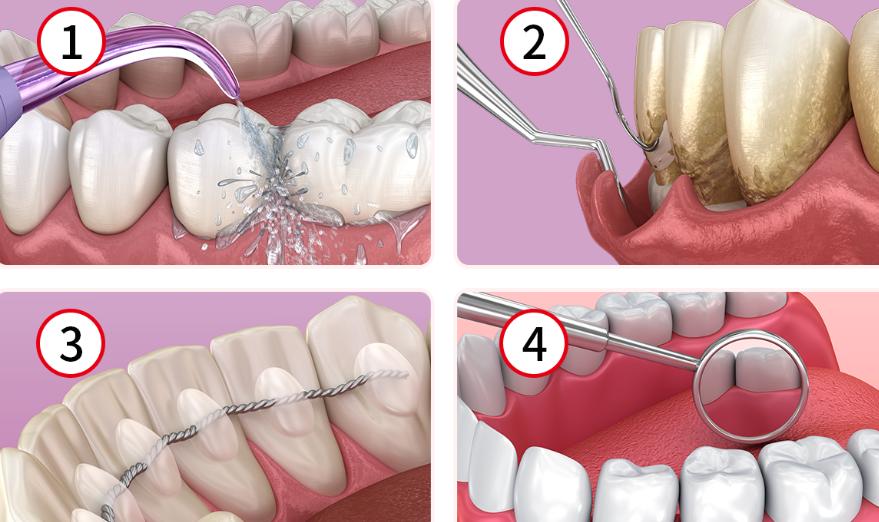 二、廣州德倫口腔牙周治療醫(yī)生團(tuán)隊(duì)：周敏/陳麗/王浩等醫(yī)師坐診，資質(zhì)有確保