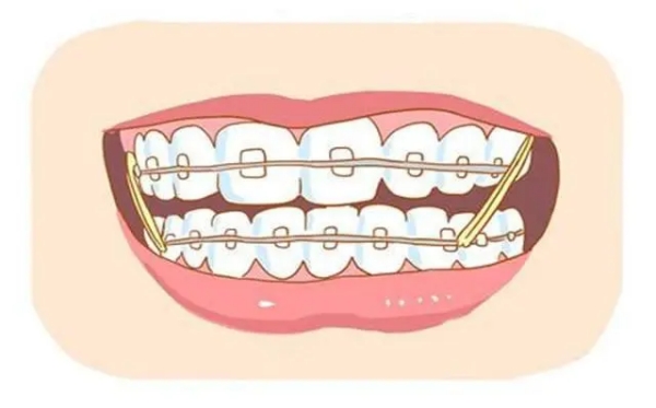 六、為什么選擇私立牙科？雅康口腔的差異化優(yōu)勢(shì)