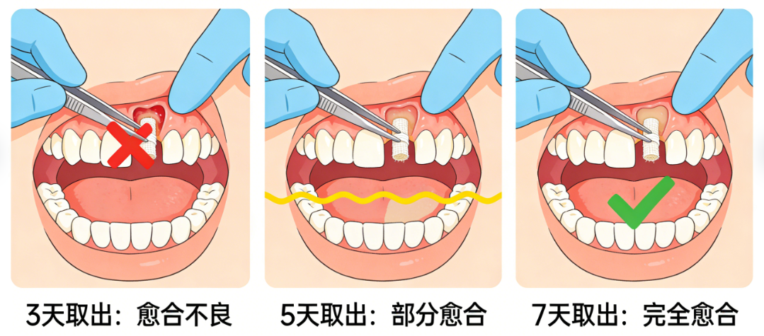 種植牙骨粉0.25g和0.5g區(qū)別大嗎？2025新版實(shí)測(cè)：?jiǎn)晤w牙0.25g夠用，瑞士進(jìn)口比國(guó)產(chǎn)貴800元
