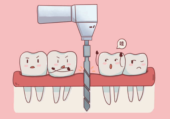 影響牙周植骨手術(shù)多少錢(qián)的 3 個(gè)關(guān)鍵因素，提前避坑