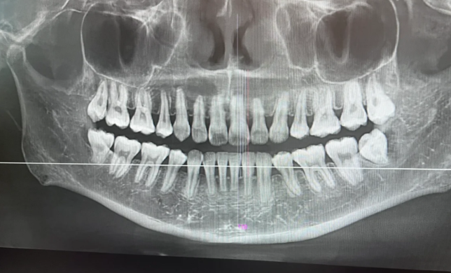 穗華口腔免費(fèi)拍片嗎