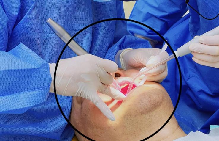 二、深圳格倫菲爾牙周治療的技術(shù)優(yōu)勢與醫(yī)生團隊