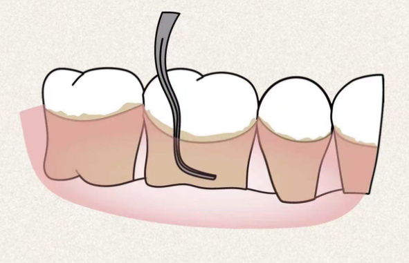 五、總結(jié)