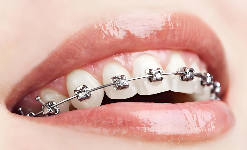 ???? 真實(shí)評(píng)價(jià)(來(lái)自患者反饋 & 我的觀察)