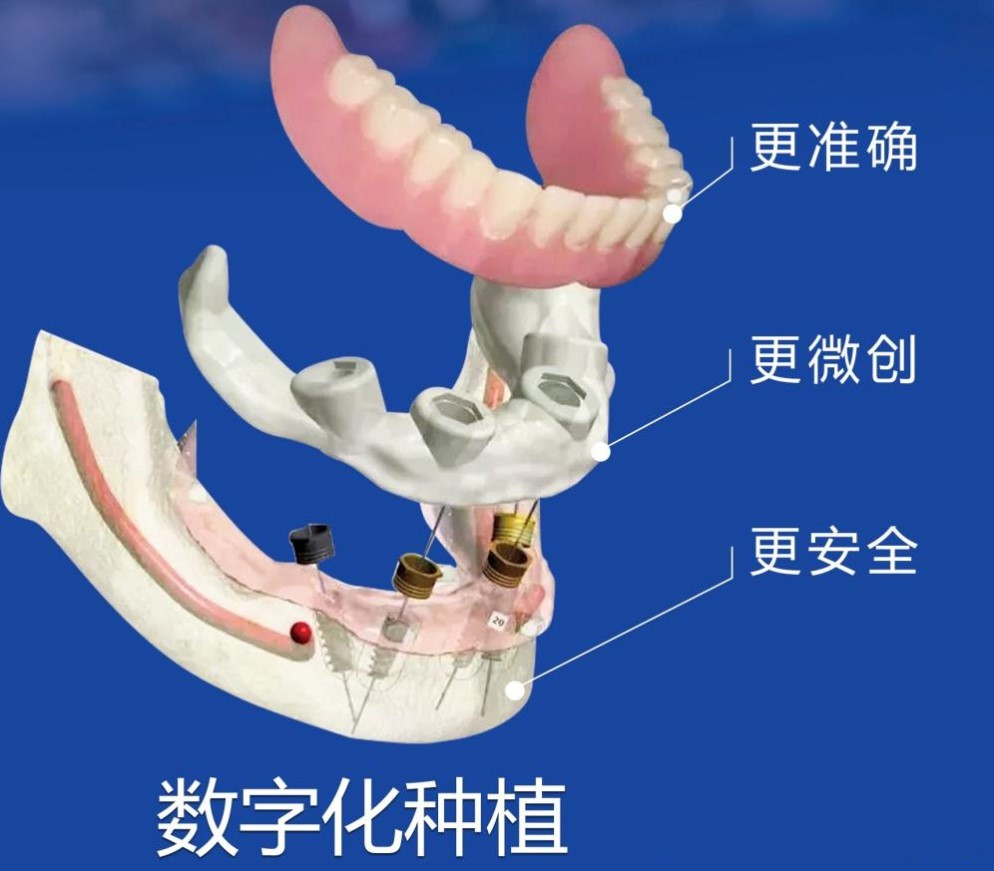 湛江港城口腔真實(shí)患者評(píng)價(jià)