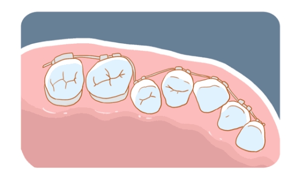 三、如何選擇適合自己的地包天矯正醫(yī)院www.gh0097.com