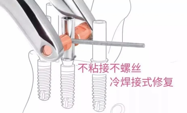 四、想了解邯鄲私立口腔診所的技術(shù)特色？這份對比別錯(cuò)過