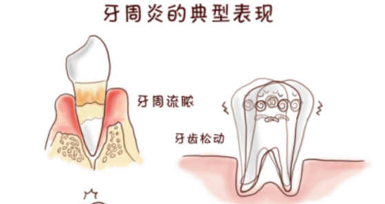 三、牙周炎就診實用攻略：如何選擇較適合的醫(yī)院