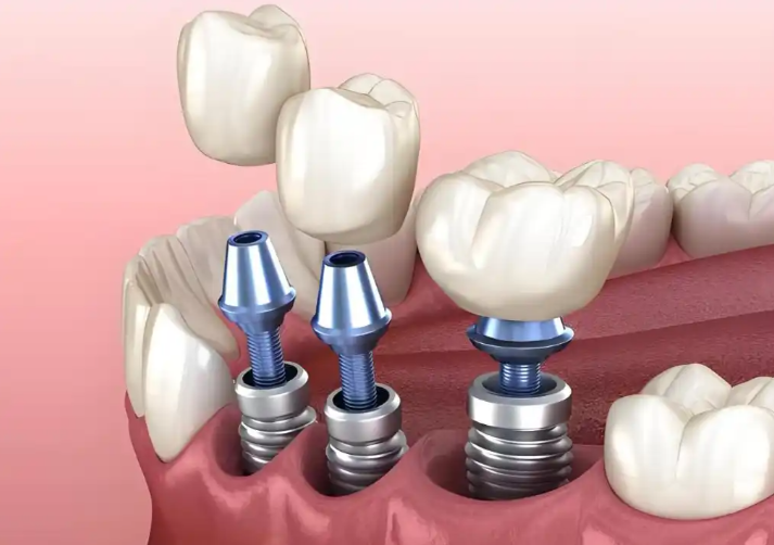 曹丹石口腔診所的服務項目與價格參考