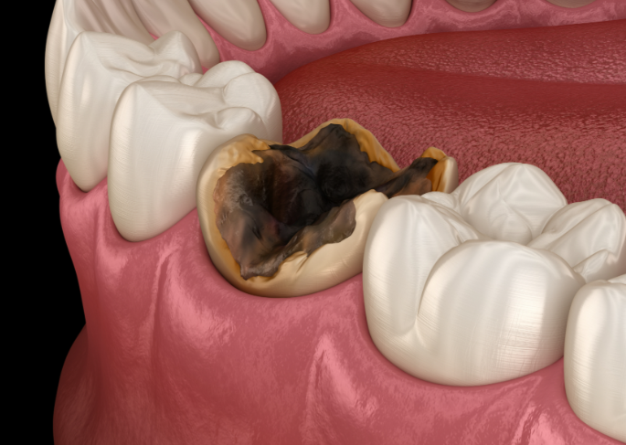 南京卡瓦口腔（雨花臺(tái)店）：注重體驗(yàn)感的“細(xì)節(jié)控”