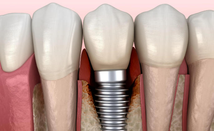 二、深圳港龍口腔詳細(xì)地址與就診攻略