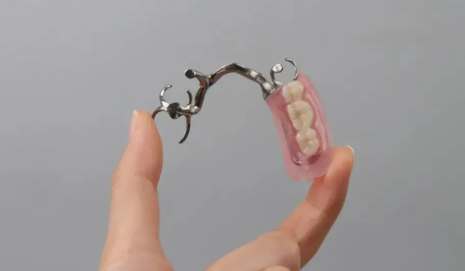 三、中喜口腔假牙服務(wù)優(yōu)勢(shì)與就診指南