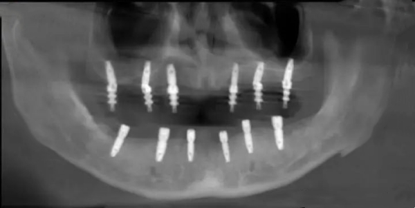 五、總結(jié)與就診建議www.ardc-srvc.com