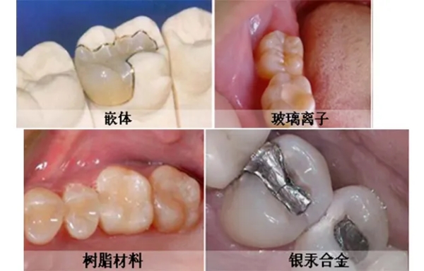 7. 邯鄲貝潔口腔——全口義齒“老人寶”，戴了能啃排骨