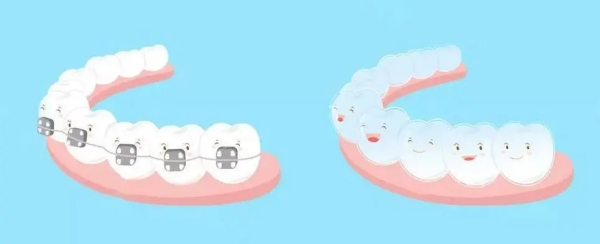 任利玲正畸患者關(guān)心的核心問題解答