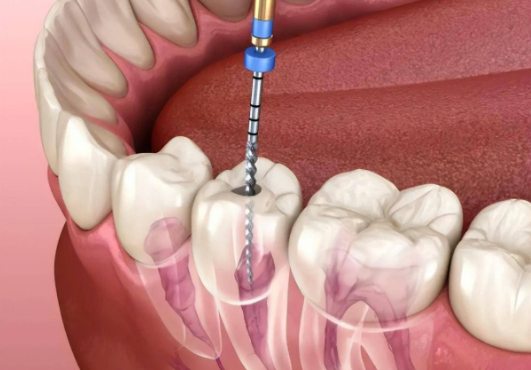 五、大連其他可做根管治療的醫(yī)院參考www.ardc-srvc.com