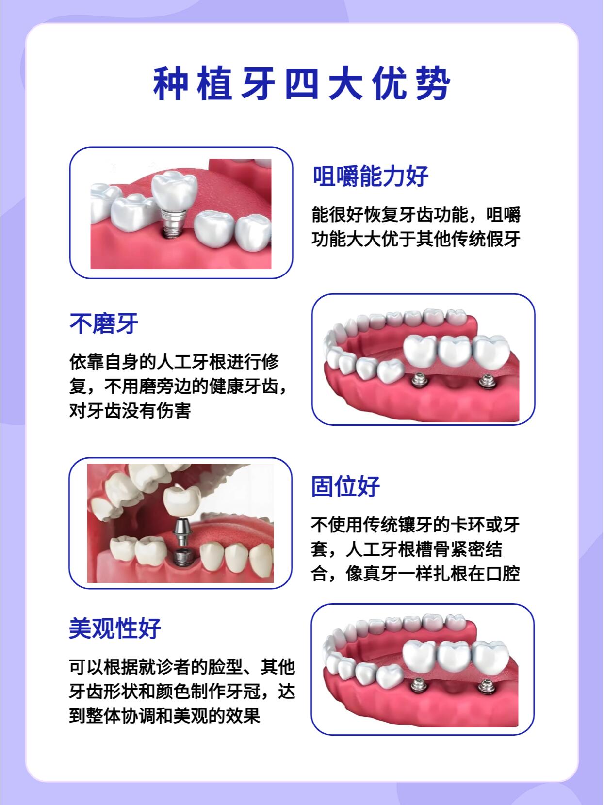 柳州德立口腔種植牙口碑好是真的！真實顧客評價+技術優(yōu)勢解析，種牙不踩坑