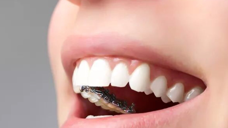 四、想了解深圳舌側(cè)矯正醫(yī)院醫(yī)生團(tuán)隊(duì)？