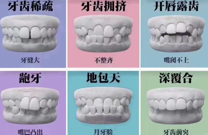 別瞎約了！武漢正畸醫(yī)生推薦：楊艷、王端瑞、甘駿捷真實口碑大起底！