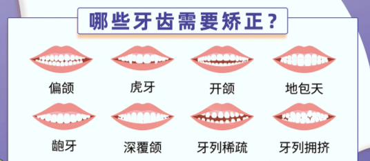 甘駿捷：是武漢正畸圈的新銳力量