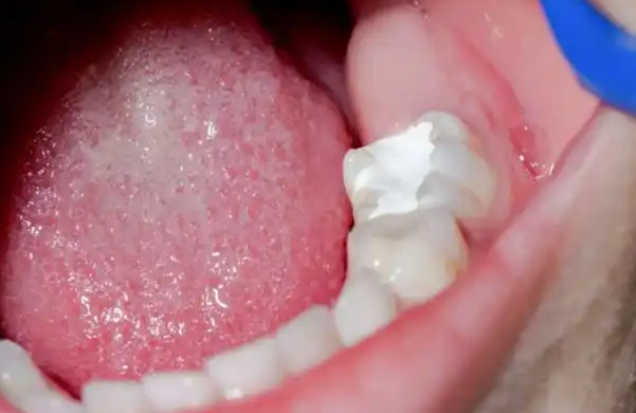 延安牙科小白兔和致美哪個好？種牙/矯正/兒童齒科全維度PK！